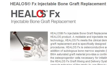 Nuova tecnica chirurgica per riparare velocemente le ossa rotte: HEALOS fx ricorda Wolverine!!! Nuova tecnica chirurgica per riparare velocemente le ossa rotte: HEALOS fx ricorda Wolverine!!!