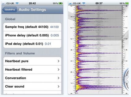 Addio allo stetoscopio... benvenuto iPhone!