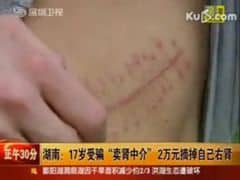 Ragazzina cinese vende un rene per comprarsi l'iPad 2